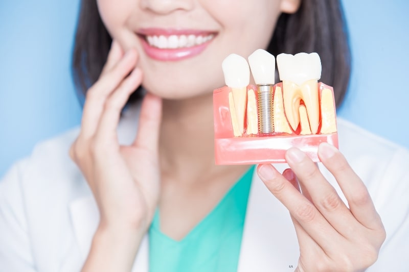 7 dicas de como escolher um dentista em Moema